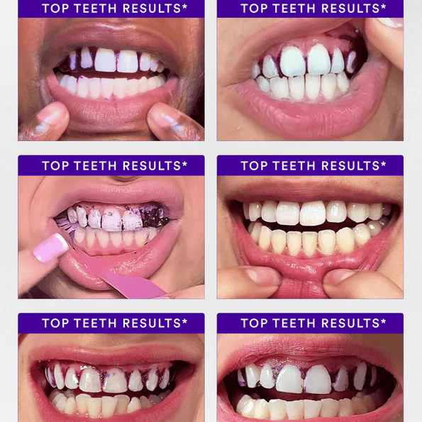 V34 Whitening Strips - Image 2